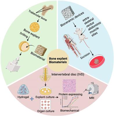 Advance in the application of organoids in bone diseases